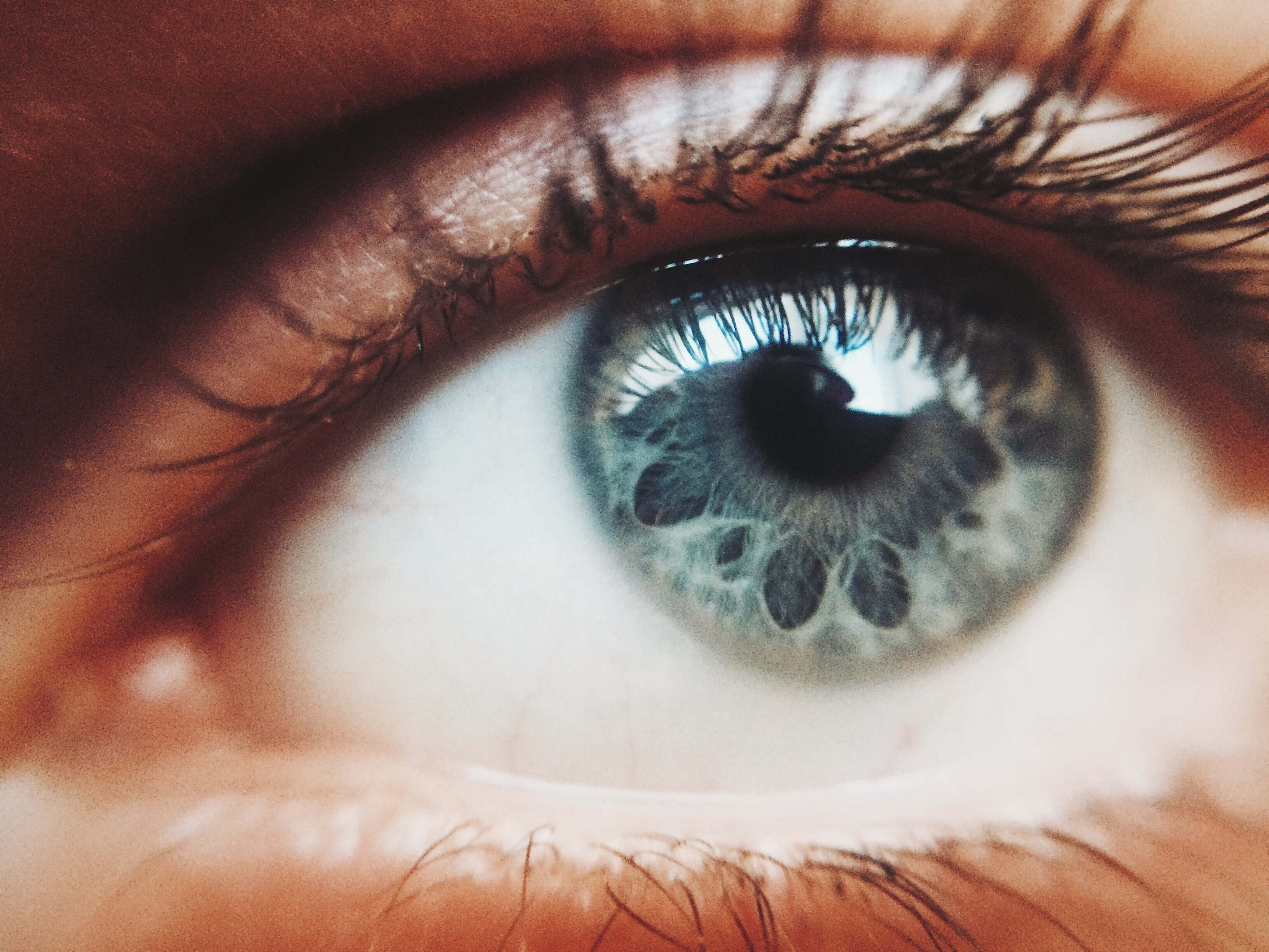 Что глаза могут сказать о вашем здоровье: 10 важных моментов-Фото 3