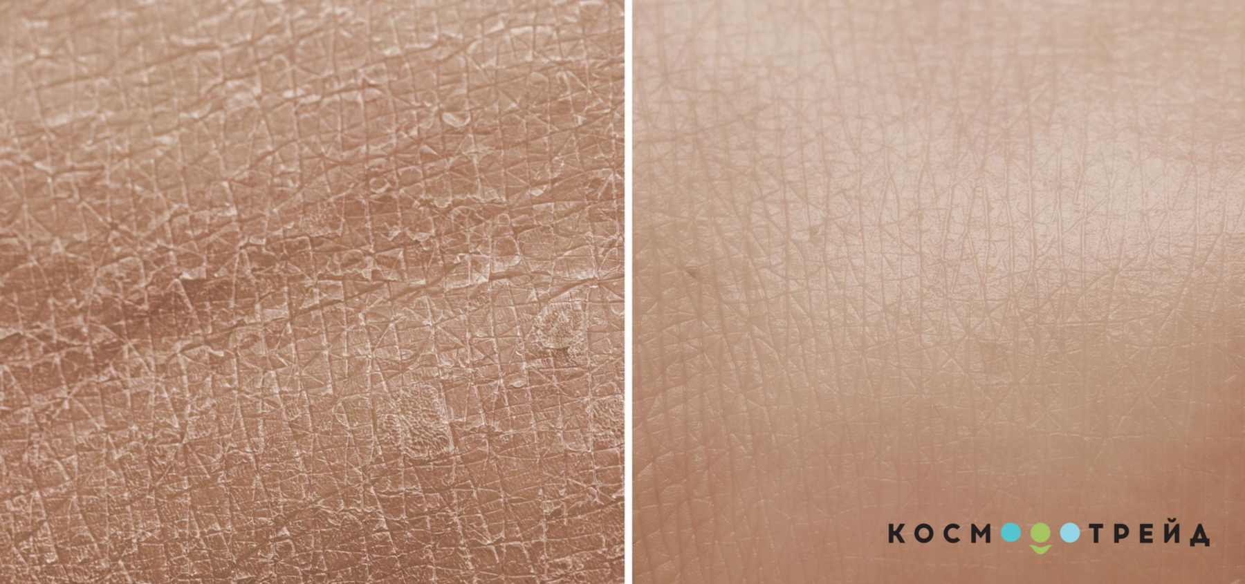 Чому зволоження шкіри тіла - це дуже важливо
